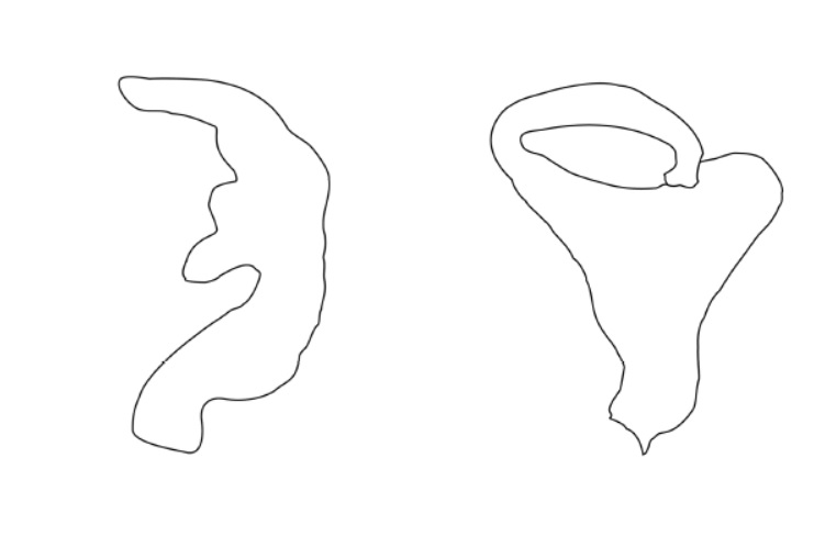 Genitália de Pycnoderes quadrimaculatus